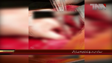 Abbottabad- First successful operation of a 10 year old boy heart