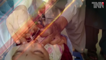 Islamabad- Polio Cases reached 100 in Pakistan
