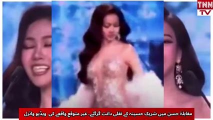 Beauty Pageant Contestant’s Veneers Fall Mid-Speech